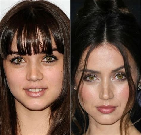 Ana de Armas Before and After Plastic Surgery: Nose, Boob